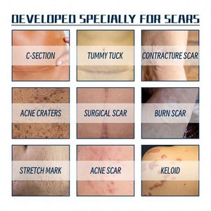 Gel réparateur cutané en gros pour cicatrices de chirurgie et de <span class=keywords><strong>grossesse</strong></span>, lissant la peau, 20g - Product Image 2