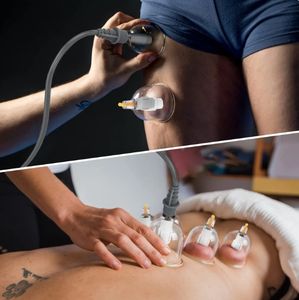 Ensemble de thérapie par ventouses Ensemble de ventouses sous vide Pots de physiothérapie de massage Médecine chinoise Hijama anti-<span class=keywords><strong>cellulite</strong></span> - Product Image 6