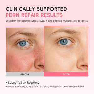 Suero Facial LAIKOU PDRN CICA con Ácido Hialurónico, Niacinamida, Acetil Hexapéptido-8 y Vitamina C, 17 ml, Hidratante, Radiante, Voluminizador, para una Piel Brillante - Product Image 4