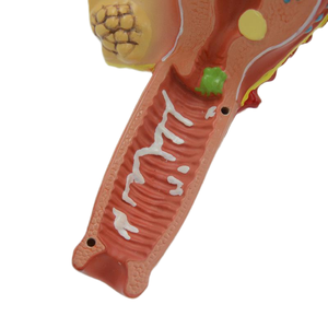 מודל הרחם פתולוגי (2-קטע)-הפאת הפתולוגיה הנשית - Product Image 3