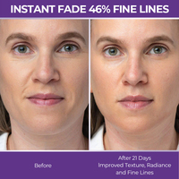 Produits de soins de la peau coréens Pro xyline vitamine C soins de la peau Anti-âge sérum raffermissant blanchissant pour le visage