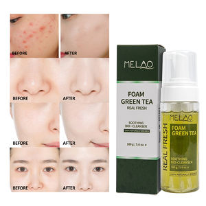 Nettoyant pour le visage à <span class=keywords><strong>la</strong></span> vitamine C de marque privée mousse nettoyante pour le visage curcuma aloès thé vert bulle de noix de coco pour éclaircir <span class=keywords><strong>la</strong></span> peau - Product Image 4