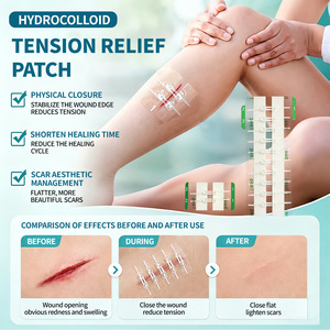 Parche hidrocoloide transparente para alivio de la tensión, sutura adhesiva médica para el manejo de cicatrices, primeros auxilios para adultos - Product Image 1