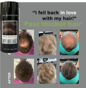 Spray de Fibra Capilar para el Crecimiento del Cabello, 100% Natural a Base de Hierbas, Alta Calidad, 60ML*3 Botellas, Eternal <span class=keywords><strong>Elinor</strong></span>, ¡Oferta! - Product Image 6