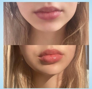 Venta al por mayor tingle <span class=keywords><strong>plump</strong></span> <span class=keywords><strong>it</strong></span> calidad LIP plumper Extreme pen Etiqueta Privada - Product Image 6