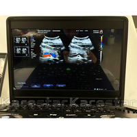 K-C102 Portable 15 pouces écran vétérinaire entièrement numérique ordinateur portable 3D 4D couleur Doppler Diagnostic Machine à ultrasons