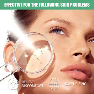 Gel d'Aloe Vera Lotion réparatrice pour la peau et les coups de soleil Ecran solaire pour le corps - Product Image 3