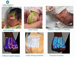 Vf15 thủng chức năng xách tay tĩnh mạch đọc mạch máu người xem venography DOPPLER hồng ngoại Máy quét Detector tĩnh mạch trực quan - Product Image 3