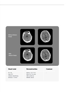 <span class=keywords><strong>Scanner</strong></span> CT vétérinaire à 40 coupes extra-larges – Machine d'imagerie par tomodensitométrie pour animaux de compagnie, pour hôpitaux vétérinaires, diagnostic d'imagerie pour chiens, chats, chevaux - Product Image 3