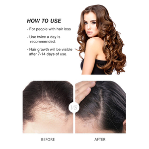 Venta al por mayor de <span class=keywords><strong>productos</strong></span> <span class=keywords><strong>para</strong></span> <span class=keywords><strong>la</strong></span> pérdida de <span class=keywords><strong>cabello</strong></span> africanos 100%, <span class=keywords><strong>productos</strong></span> orgánicos <span class=keywords><strong>naturales</strong></span> <span class=keywords><strong>para</strong></span> el cuidado <span class=keywords><strong>del</strong></span> <span class=keywords><strong>cabello</strong></span> de etiqueta privada, 30ml de aceite de suero <span class=keywords><strong>para</strong></span> el crecimiento <span class=keywords><strong>del</strong></span> <span class=keywords><strong>cabello</strong></span> - Product Image 5