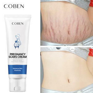 Crème <span class=keywords><strong>Anti</strong></span>-Vergetures Maternité 100% Naturelle et Végane Pour le Ventre, la Poitrine, les Hanches et les Cuisses – Élimine l'Acné Post-Partum et les Cicatrices - Product Image 4