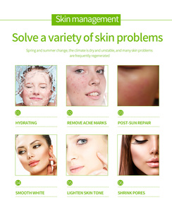 Private Label Acne Pele Creme Herbal Planta Fórmula <span class=keywords><strong>Aloe</strong></span> Hidratante Acne Creme - Product Image 5