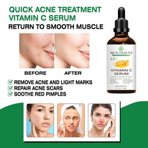 <span class=keywords><strong>เซ</strong></span><span class=keywords><strong>รั่</strong></span><span class=keywords><strong>ม</strong></span>บำรุงผิวหน้า <span class=keywords><strong>ROUSHUN</strong></span> ช่วยให้ผิวขาวกระจ่างใส ด้วยวิตา<span class=keywords><strong>ม</strong></span>ินซี เห<span class=keywords><strong>ม</strong></span>าะสำหรับทุกสภาพผิว - Product Image 3