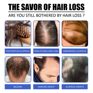 <span class=keywords><strong>Spray</strong></span> capillaire au gingembre EELHOE, nourrit en douceur les <span class=keywords><strong>cheveux</strong></span>, hydrate pour une douceur et une brillance, <span class=keywords><strong>spray</strong></span> <span class=keywords><strong>hydratant</strong></span> pour le traitement des <span class=keywords><strong>cheveux</strong></span> - Product Image 3