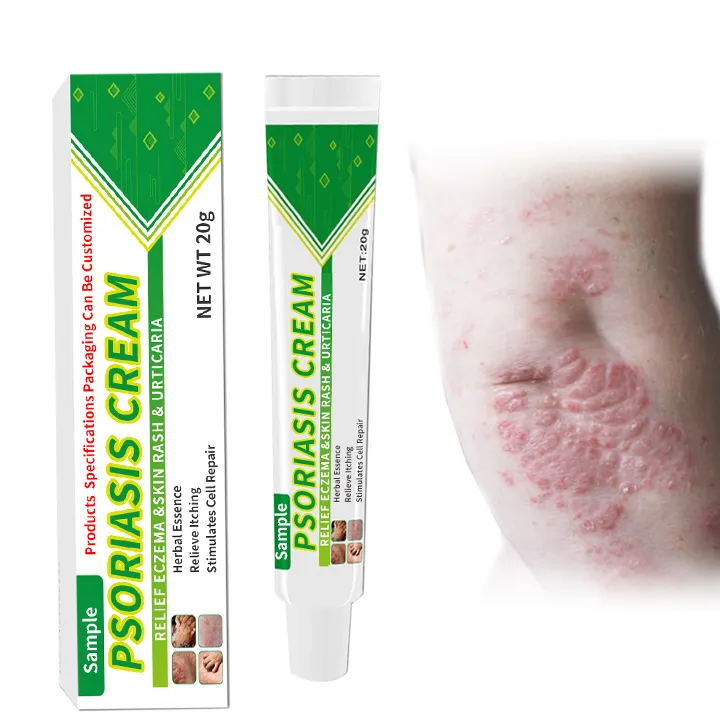OEM/ODM Psoriasis Treatment Eczema Pruritus Itching skin Cream Ointment