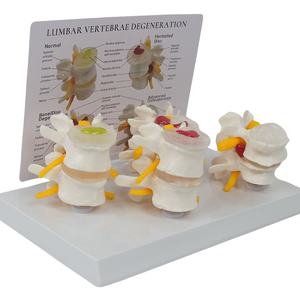 โมเดลกระดูกสันหลังส่วนเอวทางพยาธิวิทยาแบบ<span class=keywords><strong>4</strong></span>ขั้นตอนเครื่อง<span class=keywords><strong>ม</strong></span>ือฝึกศัลยกรร<span class=keywords><strong>ม</strong></span>กระดูกพร้อ<span class=keywords><strong>ม</strong></span>บัตรสำหรับการศึกษาวิทยาศาสตร์การแพทย์ - Product Image 5