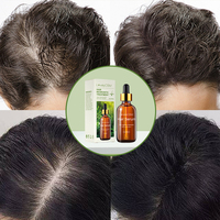 Huile Essentielle de Gingembre et Romarin en Gros pour la Repousse des Cheveux, Traitement Réparateur Anti-Chute Poria Cocos, Sérum de Croissance Capillaire
