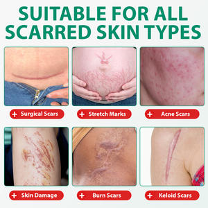 Crème réparatrice de vergetures et de cicatrices anciennes en silicone ALIVER, crème <span class=keywords><strong>anti</strong></span>-cicatrices avancée contre les taches de rousseur pour tous les types de peau - Product Image 5