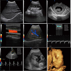 Mesin Doppler Warna 3D SUN-906A Peralatan Pencitraan Diagnostik Medis Pemindai <span class=keywords><strong>Ultrasound</strong></span> 3D Portabel Klinik - Product Image 6