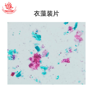 Lames de microscope d'organismes aquatiques aux structures claires et typiques, standardisées pour les laboratoires de biologie des universités, microscope - Product Image 2