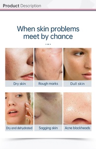 Customizable Facial Machine Hydrogen Oxygen Bubble Dermabrasion Acne Treatment Face Lift Pore Clean Hydro Beauty Machine - Product Image 6