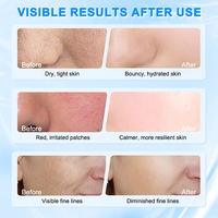 Soin Coréen PDRN ADN de Saumon Peptide Rose Niacinamide Anti-Rides 30ml Peau Éclatante Effet Verre Raffermissant Anti-Âge Visage
