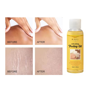 Aceite Esencial de Romero 100% Puro y Natural, Extra Fuerte, para Cicatrices, Manchas Oscuras y Nudillos, Marca Privada OEM de Alta Calidad - Product Image 3