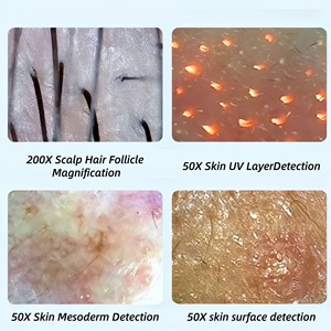 Foreign Trade High-Definition Five-in-One Hair Follicle and Scalp Detection Instrument - Product Image 4
