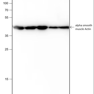 Anticuerpo Monoclonal de Actina Muscular Lisa Alfa Recombinante - Product Image 1