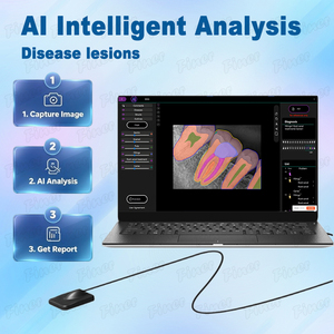 Appareil de <span class=keywords><strong>radiographie</strong></span> numérique avec capteur IA pour la pratique <span class=keywords><strong>dentaire</strong></span> moderne, système d'imagerie radiographique intra-orale - Product Image 2