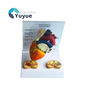 Modelo Anatómico de Fibrilación Atrial con Secciones Transversales de Corazón y Cerebro para la Enseñanza de Cardiología - Product Image 1