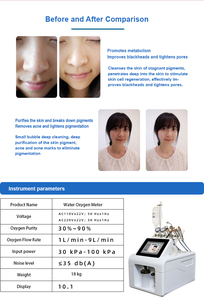 Appareil de beauté facial à oxygène pour spa, 9 en 1, BIO Face Lift, microdermabrasion, production d'oxygène, Hydra Oxygen Jet Peel, blanchiment de la peau - Product Image 4