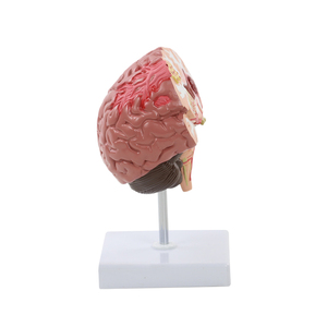 Modelo de Cerebro Humano con <span class=keywords><strong>Derrame</strong></span> Cerebral - Modelo Anatómico de Enfermedad Cerebral Patológica - Hemorragia Cerebral - Lesión Cerebral - Product Image 2