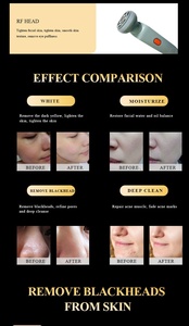 Máquina Facial de Hidrodermoabrasión con H2O2 y Oxígeno, Rejuvenecimiento Visual del Cuero Cabelludo, Hidro Microdermoabrasión, Dispositivo de Belleza <span class=keywords><strong>SkinPro</strong></span> - Product Image 5