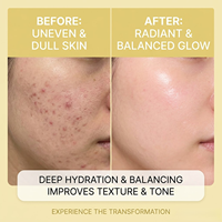 Huile de massage pour drainage lymphatique du visage, jojoba, noix de coco, vitamine E, Gua Sha, rouleau de jade pour le visage, non comédogène, végan, sans cruauté, 30 ml