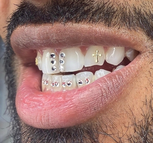 Kit Profesional de Gemas Dentales de Oro, 3 Piezas/Caja, Productos de Higiene Bucal Multiusos con Luz de Curado y Pegamento - Product Image 4