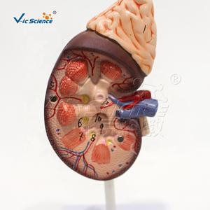 Modelo Anatómico de Riñón Humano para Ciencias Médicas, 2 Partes, Modelo Anatómico de la Estructura del Riñón Humano - Product Image 2