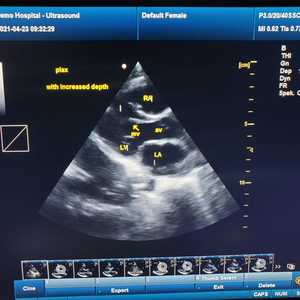 Sistema de Diagnóstico por Ultrasonido Portátil Médico <span class=keywords><strong>Doppler</strong></span> a Color Sunbright SUN-906B para <span class=keywords><strong>Ecocardiograma</strong></span> - Product Image 2