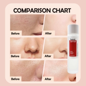 Tonique à la <span class=keywords><strong>rose</strong></span>, <span class=keywords><strong>eau</strong></span> faciale hydratante, anti-âge, apaisante pour la peau, éclaircissante, OEM, étiquette privée, soins quotidiens <span class=keywords><strong>de</strong></span> la peau coréens - Product Image 6