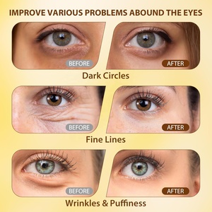 Crema para apretar los ojos Reduce las ojeras y las líneas finas, hidratante e iluminadora, de absorción rápida para hombres y mujeres de marca privada - Product Image 6