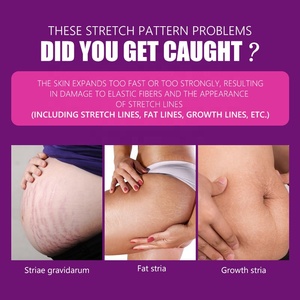 Crème <span class=keywords><strong>anti</strong></span>-vergetures Guanjing, crème réparatrice pour les cicatrices de grossesse, pour les femmes enceintes, pour OEM - Product Image 3