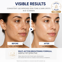 Crème Visage Coréenne à l'Acide Kojique, Niacinamide et Vitamine C – Hydratante, Éclaircissante, Anti-Taches Brunes et Anti-Teint Terne