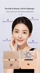2-in-1 Picosecond Laser Pen Ice Hammer 1064/532nm Tattoo Pigment Removal Skin Cooling Soothing Portable <b>ABS</b> Soap Beauty Machine - Product Image 6