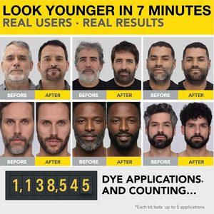 Cleverman <strong>Hair</strong> &amp; Beard <strong>Dye</strong> Kit for Men-All-in-One Reusable Cream Ammonia-Free Natural Gray Coverage Medium Brown - Product Image 4