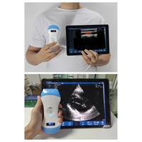 Hochwertiger 3-in-1 Kabelloser Ultraschall-Scanner mit Konvex- und Linearschallkopf, Multimodus-Ultraschallgerät