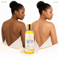 Huile d'acide kojique biologique à étiquette privée, huile de massage corporel éclaircissante, élimine les taches brunes et hydrate le visage, soin de la peau OEM 200 ml