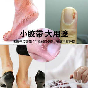 เทปปิดแผลฮอนส์ เมดิคอล ขนาด 2.5 ซม. x 200 ซม. สำหรับผิวหนังแตก สีขาว ทำจากผ้าไม่ถักทอ - Product Image 4