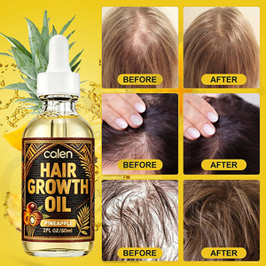Luxfume – Kit complet de soins capillaires Chebe et Huile de Batana sous marque privée pour la réparation des cheveux bouclés, secs, abîmés et surtraités, favorisant la croissance - Product Image 3