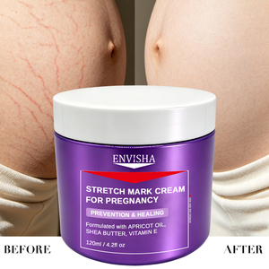 Crème anti-vergetures en gros <span class=keywords><strong>pour</strong></span> l'abdomen, <span class=keywords><strong>les</strong></span> cuisses, <span class=keywords><strong>les</strong></span> jambes, <span class=keywords><strong>les</strong></span> fesses et <span class=keywords><strong>la</strong></span> poitrine, <span class=keywords><strong>pour</strong></span> l'élimination des vergetures de <span class=keywords><strong>grossesse</strong></span> et le lissage de <span class=keywords><strong>la</strong></span> peau - Product Image 2