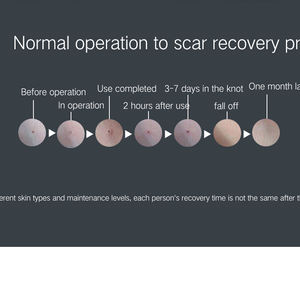 Stylo d'élimination des grains de beauté à 9 niveaux OEM ODM Dispositif d'élimination des taches de rousseur portable Outil d'élimination des taches de rousseur pour la personnalisation de la marque - Product Image 3